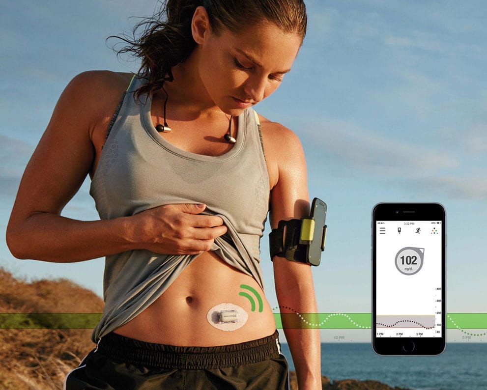 Dexcom: Bricz case study